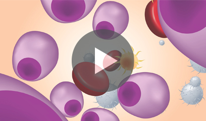 An educational video by Standing in the Gaap that shows an overview of multiple myeloma in African Americans for patients and caregivers